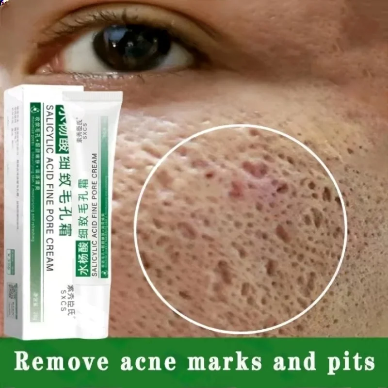 Salicylic Acid Pore Clearing C - Salicylic Acid Blackhead Remover recension och pris
